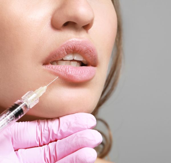 botox dermal fillers