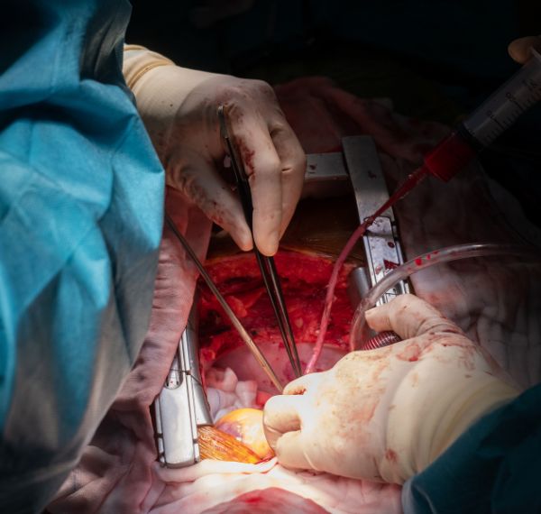 coronary artery bypass graft cabg