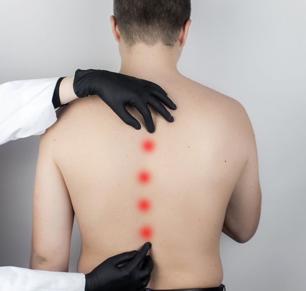 deformity correction surgery