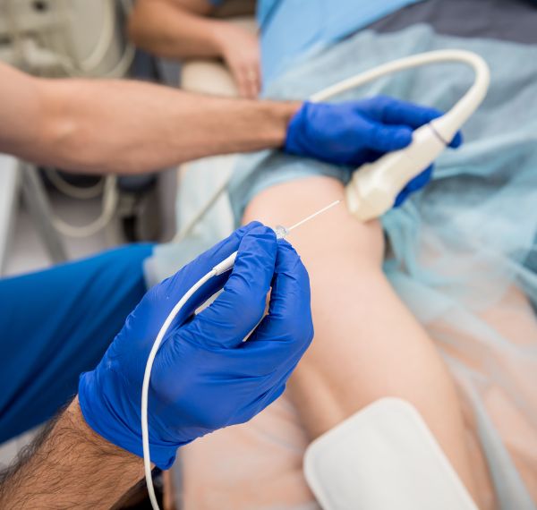 electrophysiology study ablation