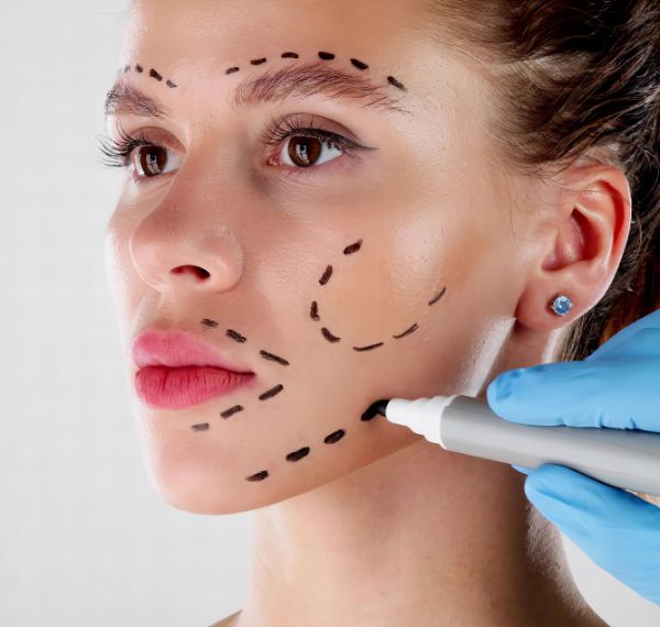 facelift surgery rhytidectomy