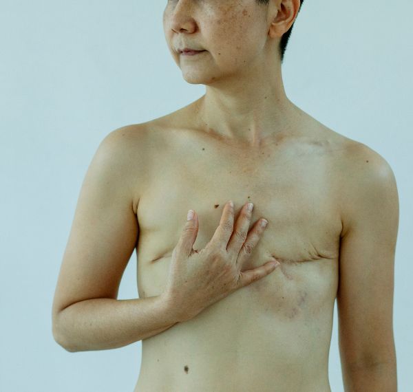 gynecomastia surgery male breast reduction