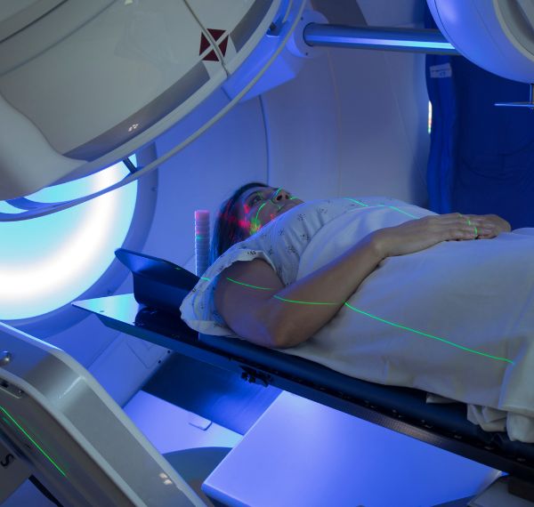 radiation therapy