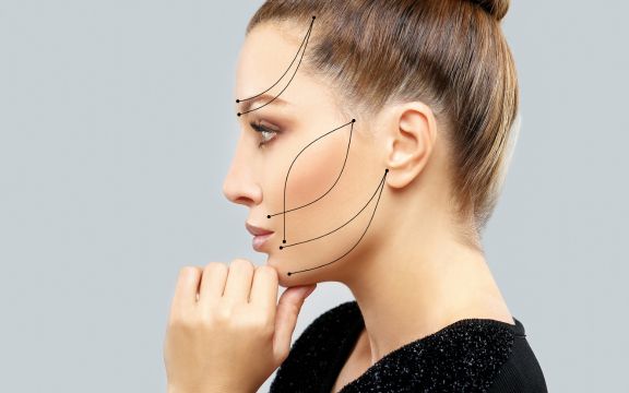 rhytidectomy facelift